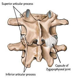 Facet Disease / Facet Syndrome