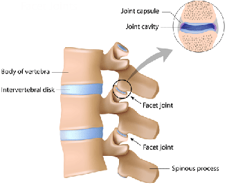 Facet joint injection