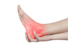 Arthritis pain