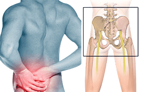 Sacro-iliac Joint Pain