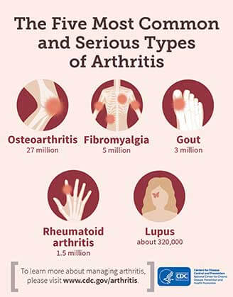 Arthritis Types