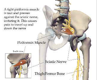 Piriformis Syndrome: Symptoms, Causes & More