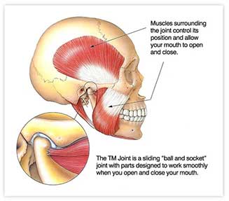 TMJ Pain